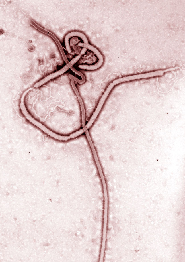 Immagine al microscopio del virus Ebola
