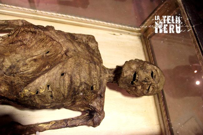 Il cadavere mummificato di Vincenzo Verzeni Il cadavere mummificato di Vincenzo Verzeni